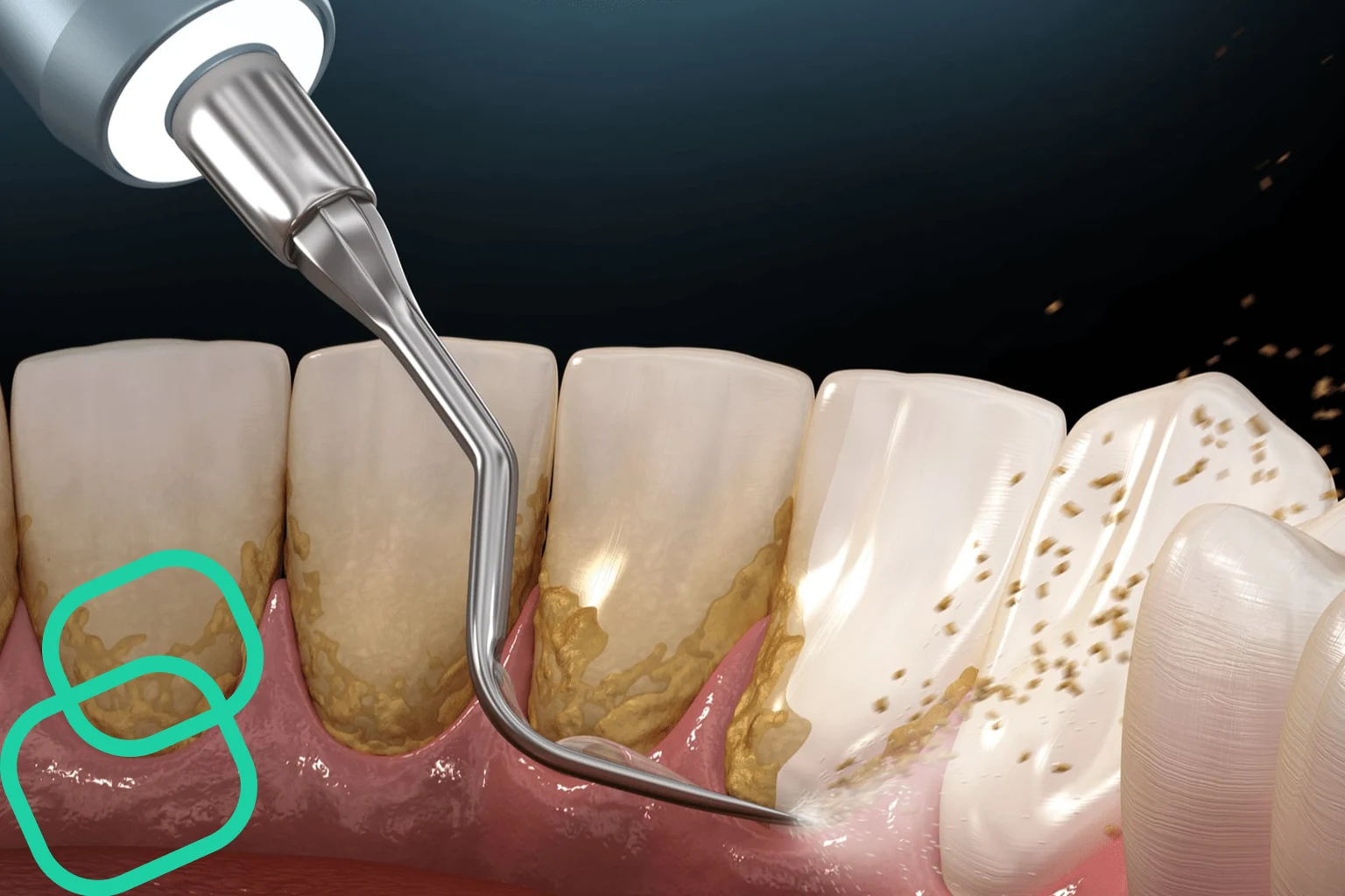 بهترین کلینیک جرم گیری دندان در تهران